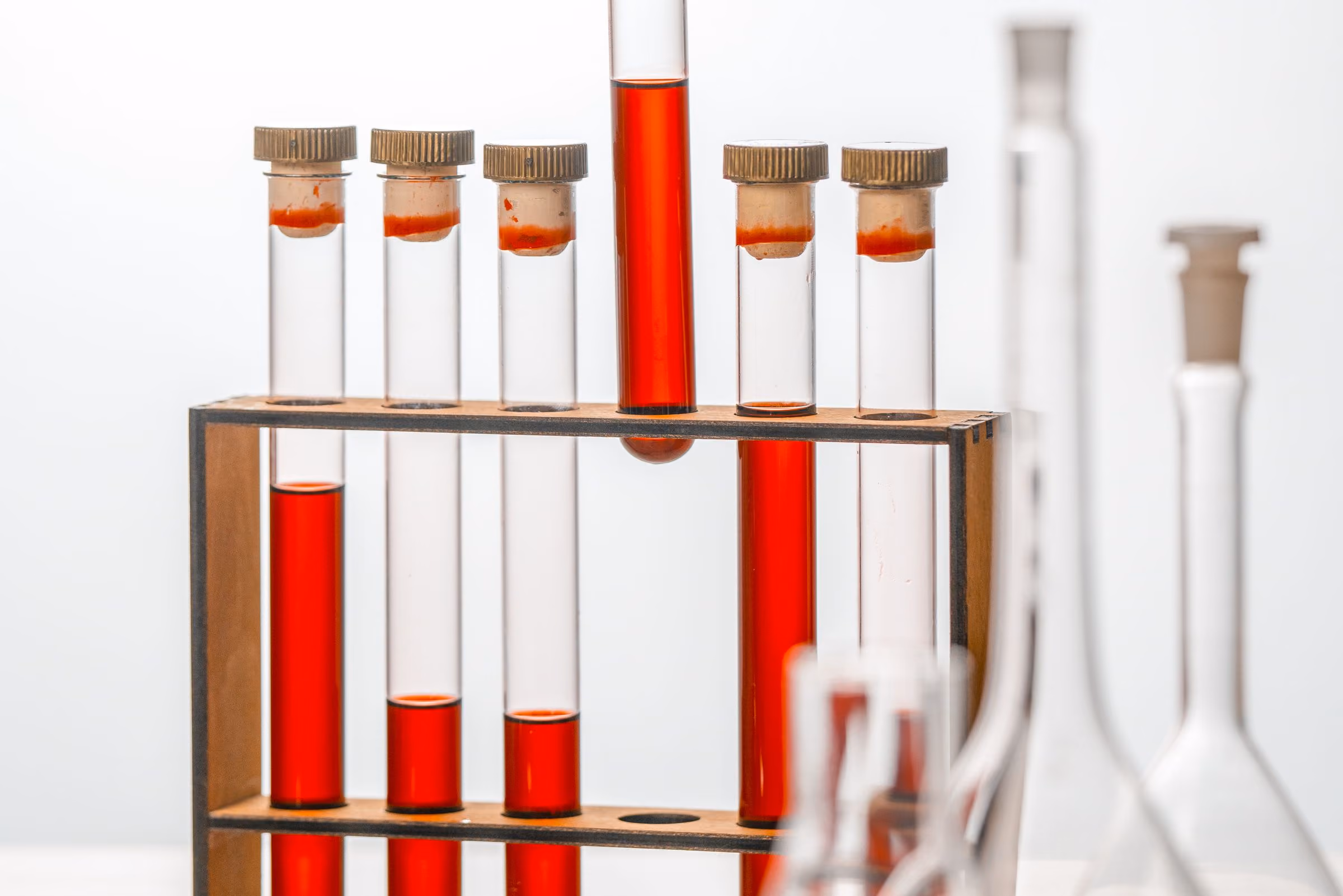 Blood sample tubes in a laboratory rack