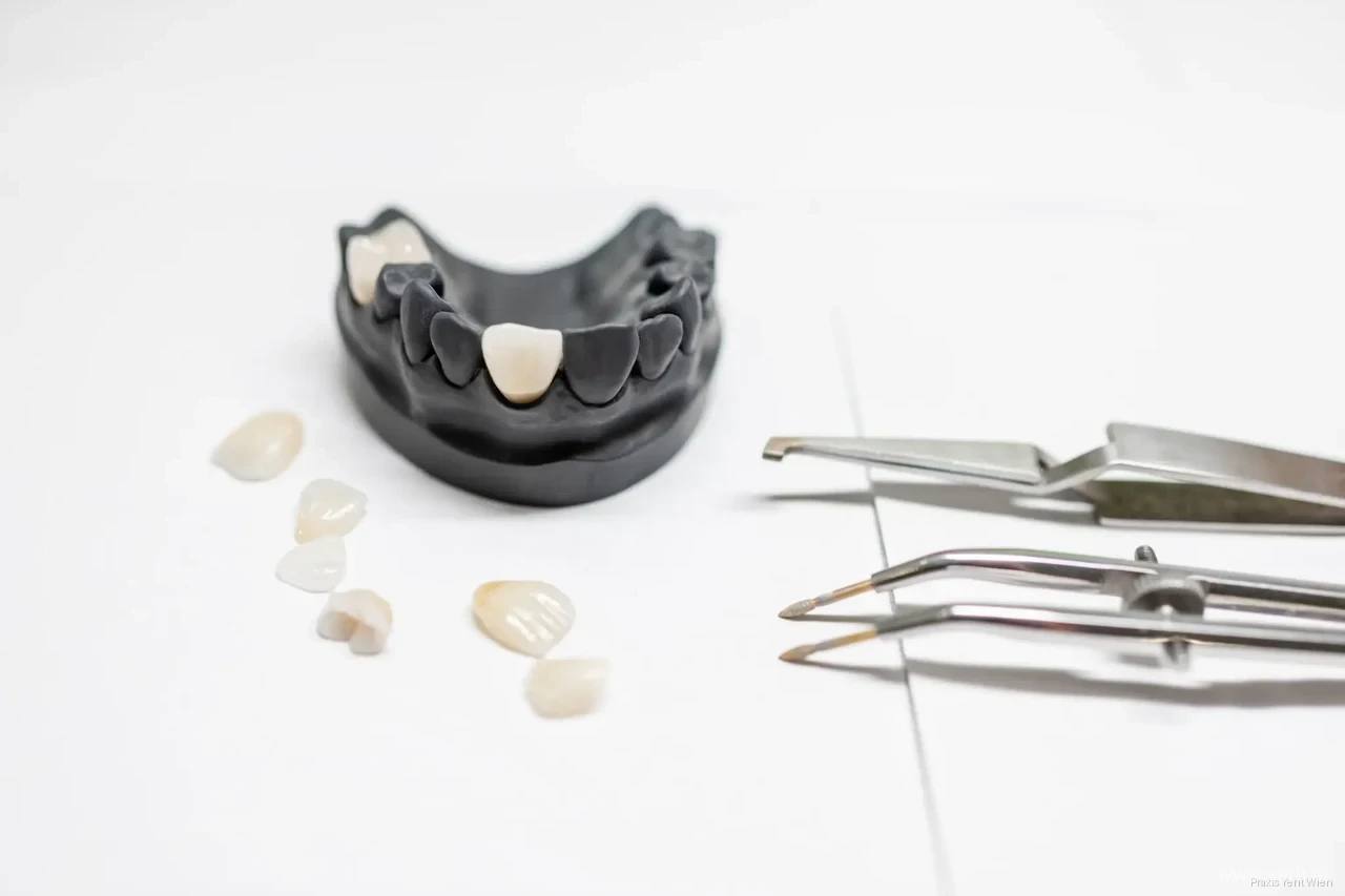Zahntechnisches Modell mit Verblendschalen und zahnärztlichen Präzisionsinstrumenten