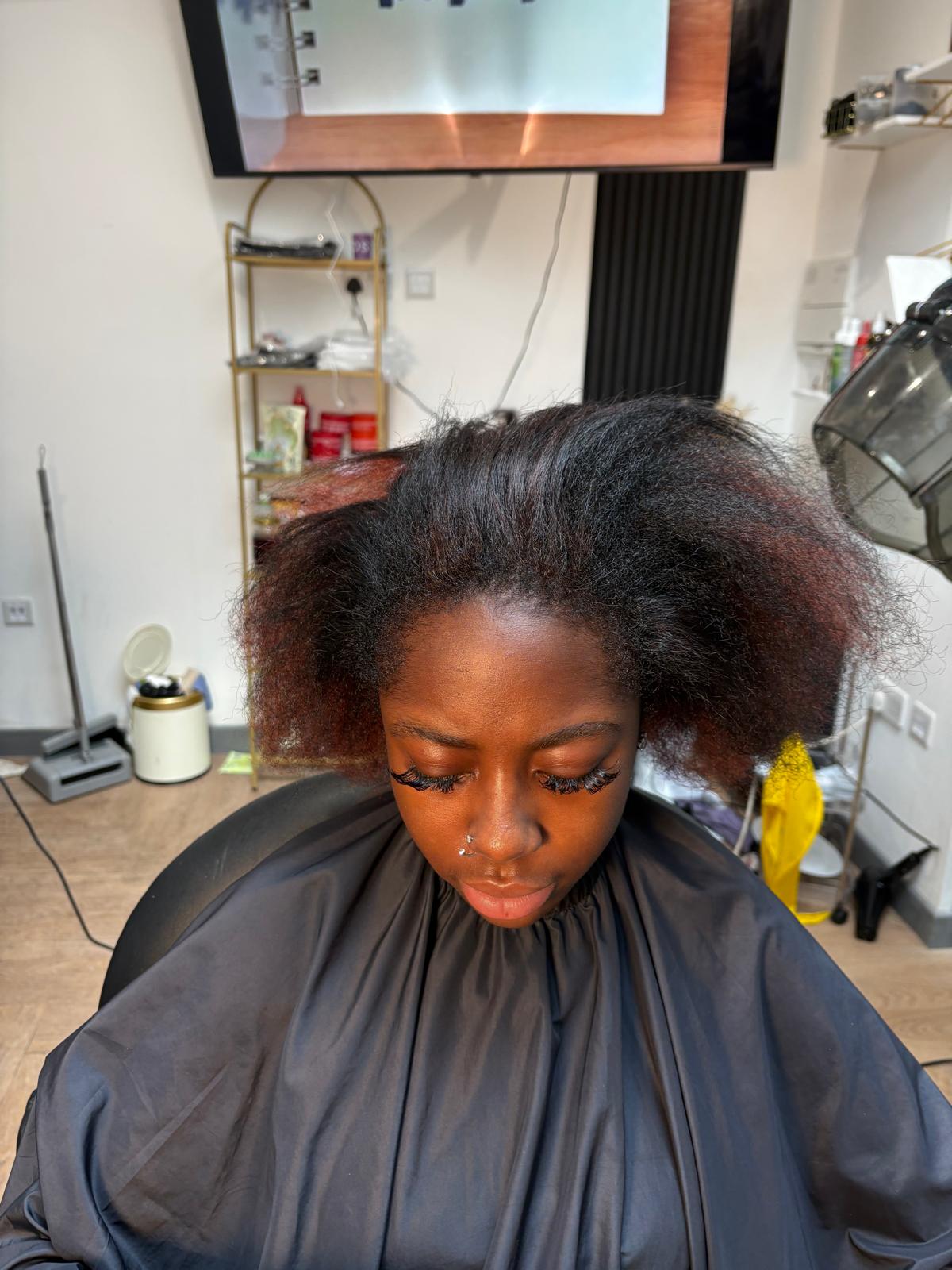 Jawline Contouring Before Treatment