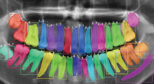 Journal figure: AI-assisted radiograph analysis in dentistry