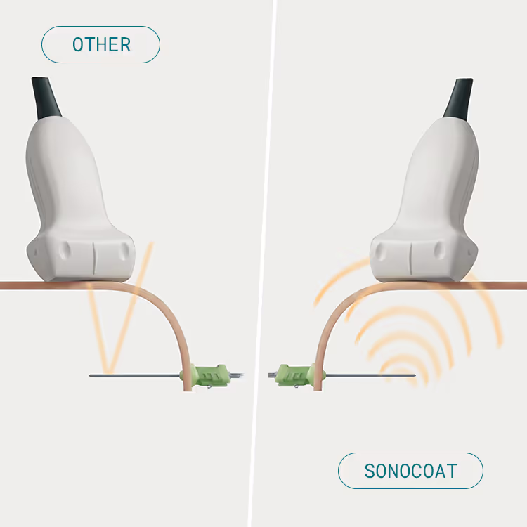 Illustration comparing ultrasound reflection from a standard needle and a SonoCoat needle