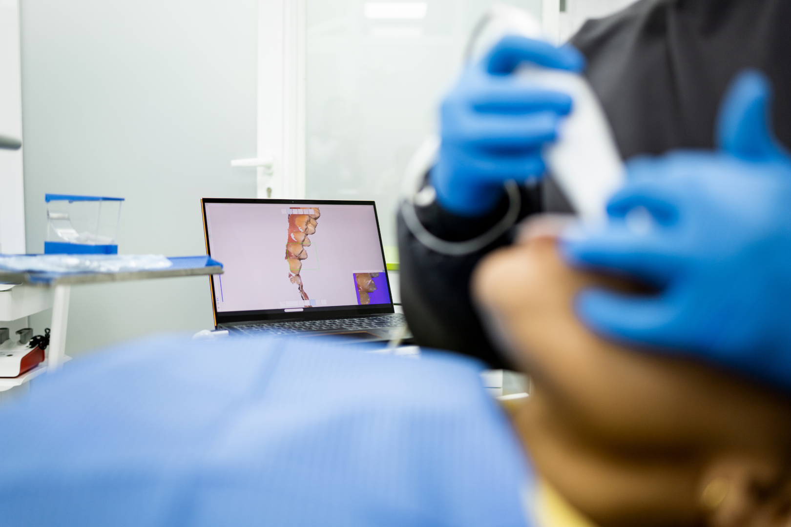 Dentist wearing blue gloves using dental scanner on patient's mouth with 3D teeth image on laptop screen.