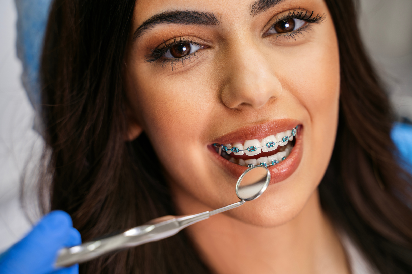 Close-up of smiling woman with braces on teeth during dental check with a mouth mirror.