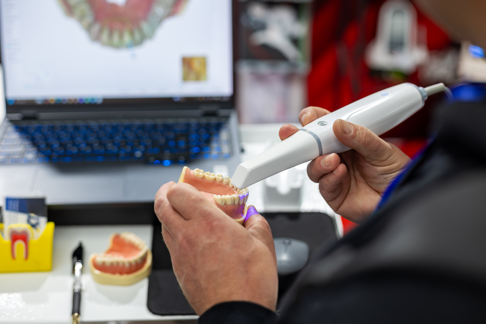 Person using a handheld scanner on a dental mold with a laptop displaying dental images in the background.