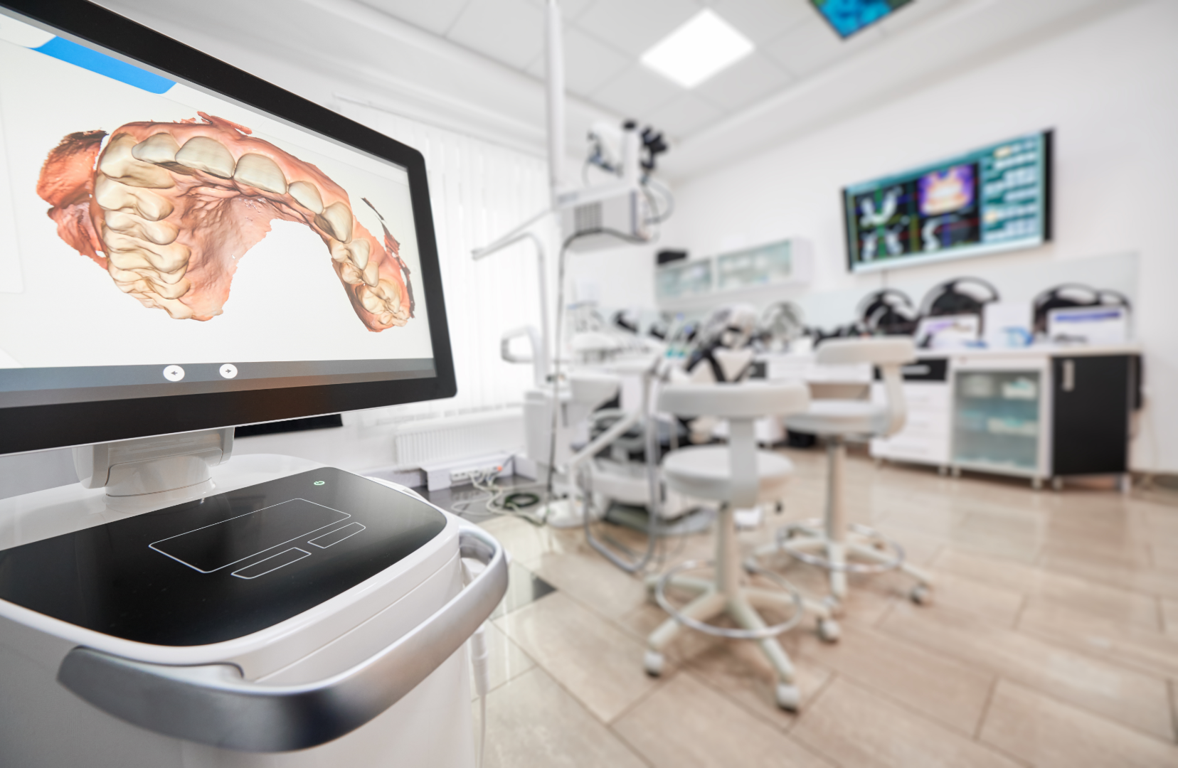 Dental office with 3D digital scan of upper jaw and teeth displayed on a monitor.