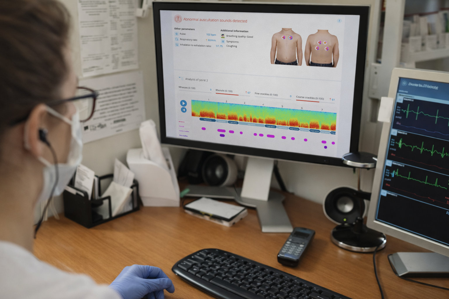 Teaching a Stethoscope to Listen: How StethoMe Built AI Physicians Can Trust