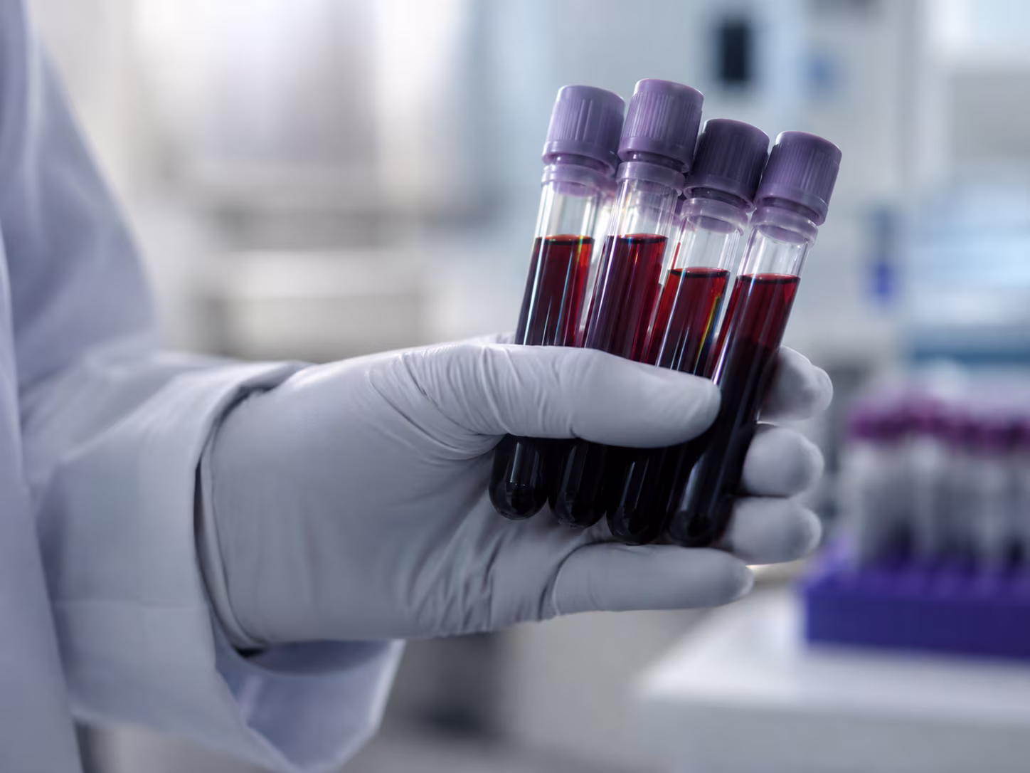Gloved hand holding four blood sample tubes with purple caps in a clinical lab setting.
