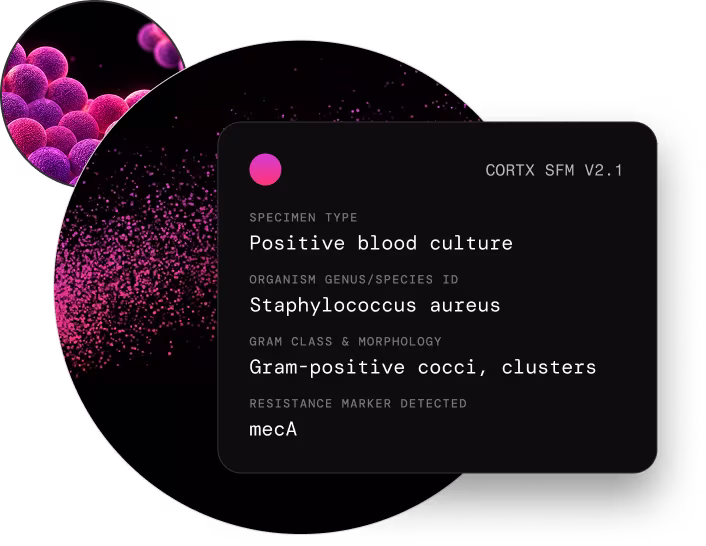 Close-up of pink and purple Staphylococcus aureus bacteria with text about positive blood culture and mecA resistance.