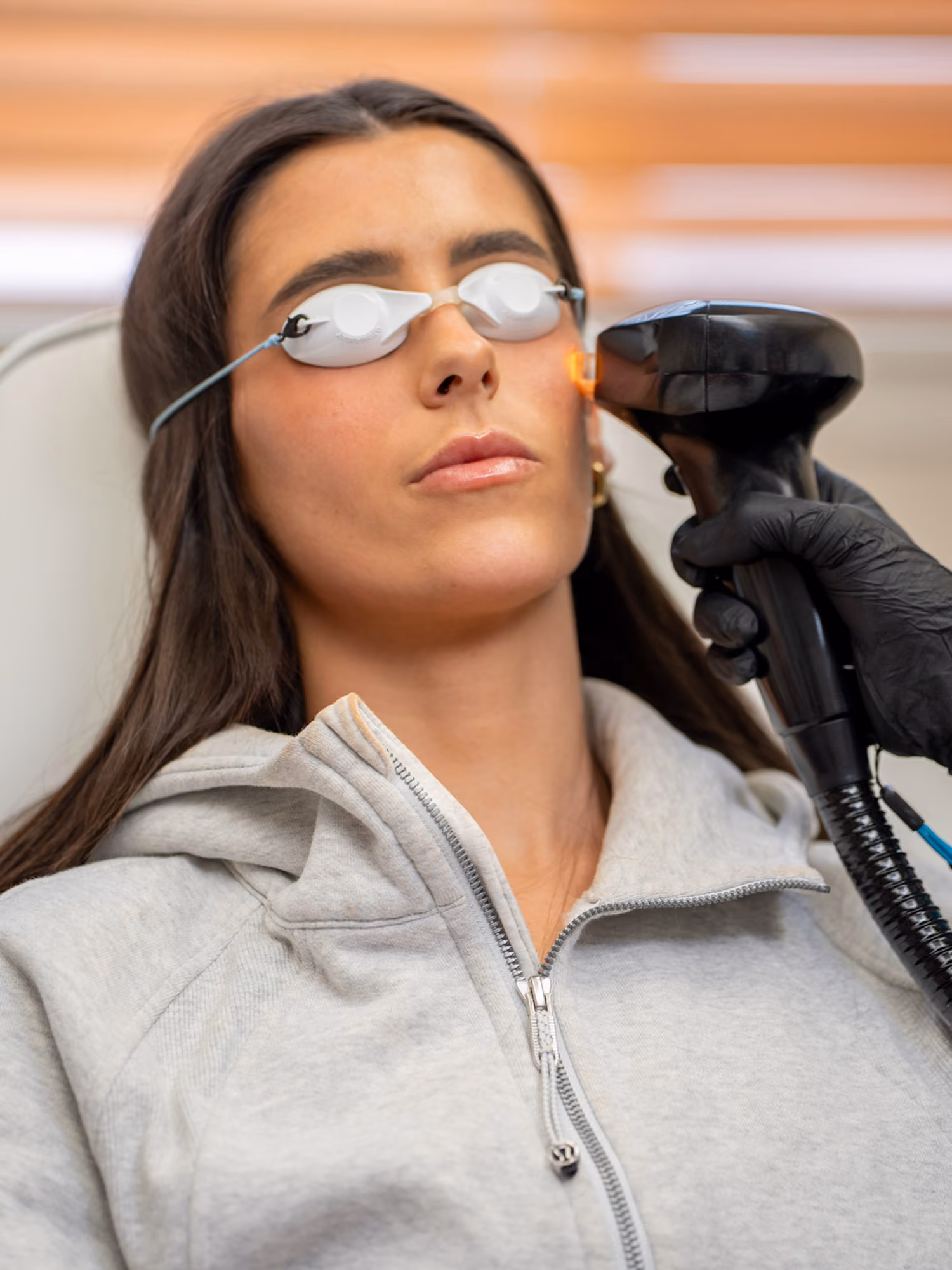 Woman wearing protective goggles receiving laser treatment on her cheek from a gloved hand.