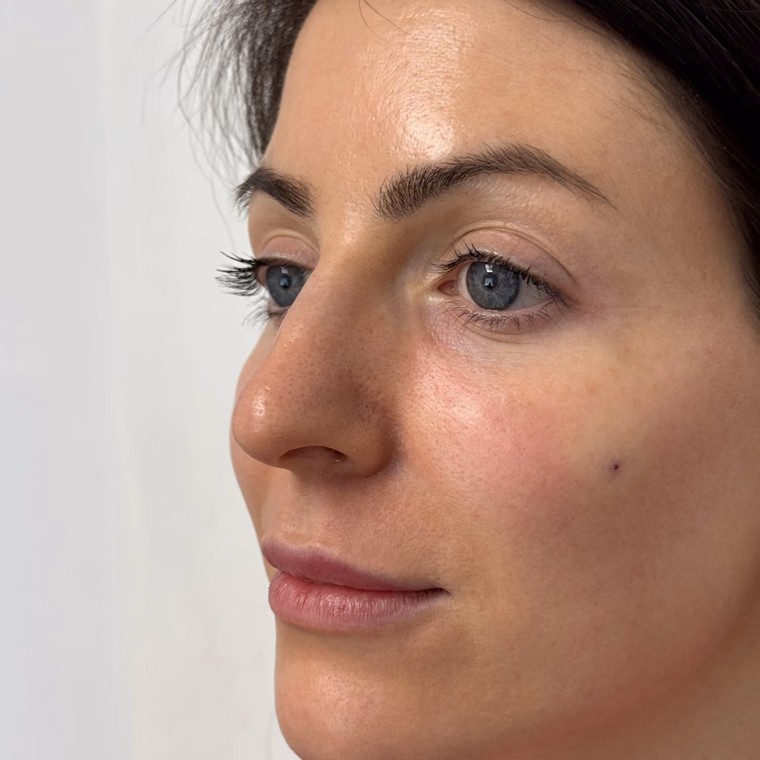 Close-up side view of a woman with blue eyes, clear skin, and a small mole on her cheek.