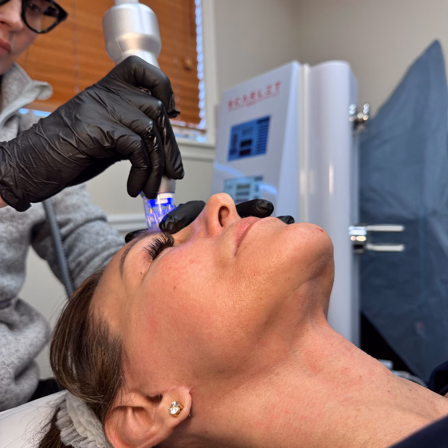 Woman receiving a facial treatment with a blue light device operated by person wearing black gloves.