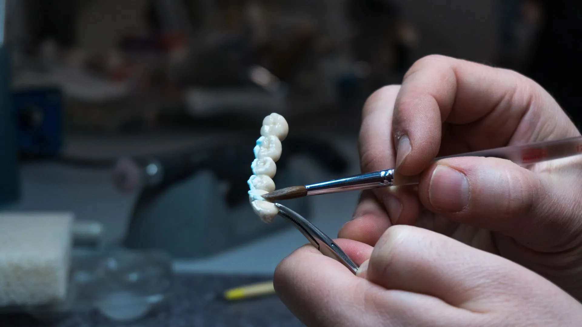 Patient smiling with a seamlessly fitted dental bridge that blends naturally with surrounding teeth