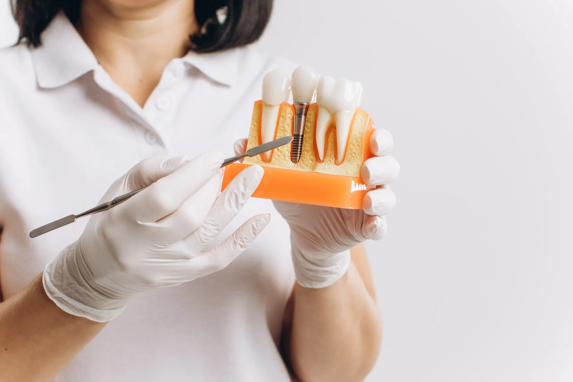Dentist reviewing a 3D X-ray scan to plan precise dental implant placement at Nova Dental Care of Vienna