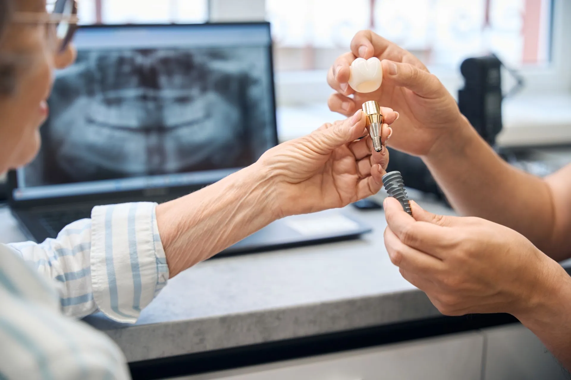 Close-up of an implant-retained denture snapping securely onto dental implants