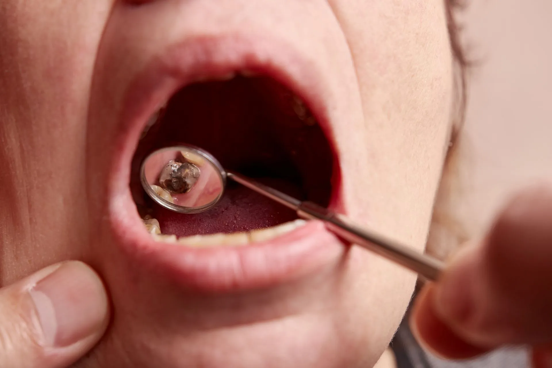Dentist using an examination light to inspect oral tissues for early signs of cancer during a dental visit