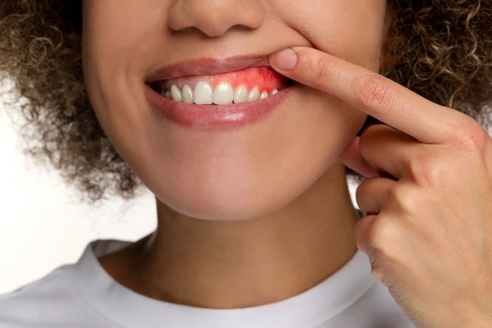 Dental laser being used to precisely reshape excess gum tissue during a gum contouring procedure