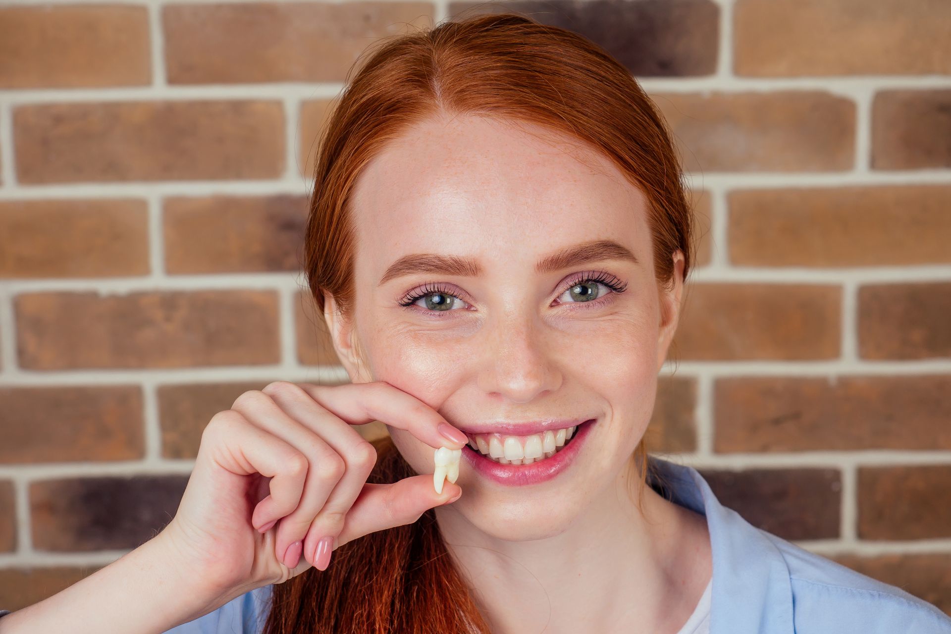 Dental X-ray showing impacted wisdom teeth requiring extraction at Nova Dental Care of Vienna