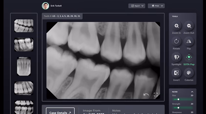 Dental X-ray image of multiple teeth displayed in a software interface with various editing tools.