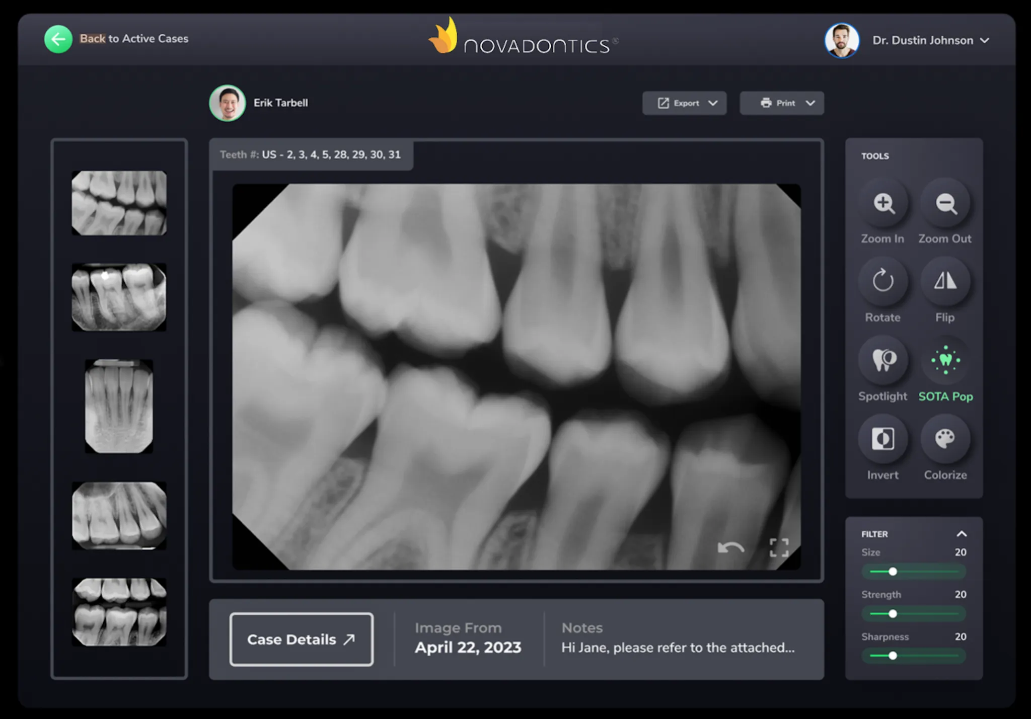 Dental X-ray image showing multiple teeth, with tool options like zoom, rotate, flip, and colorize on screen.