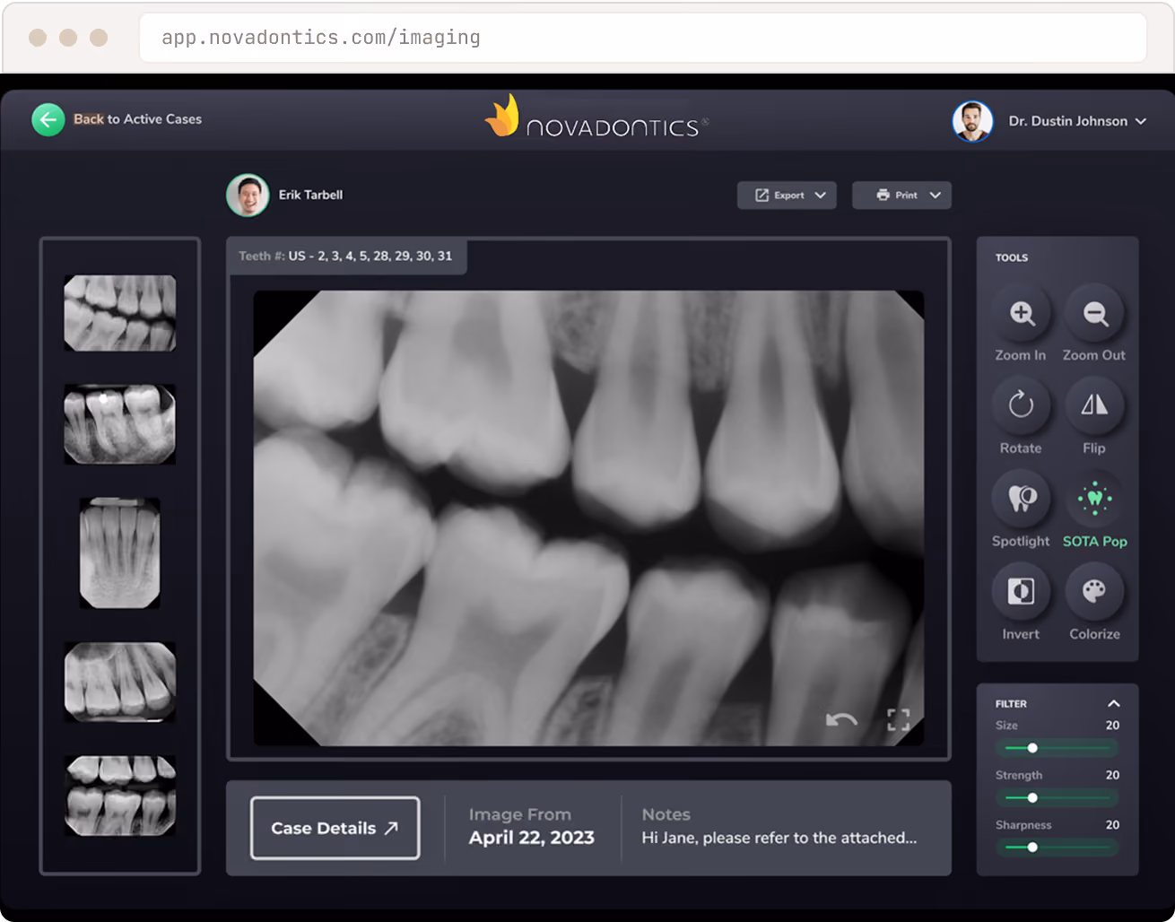Dental X-ray imaging software showing detailed teeth X-ray with zoom and filter tools on screen.