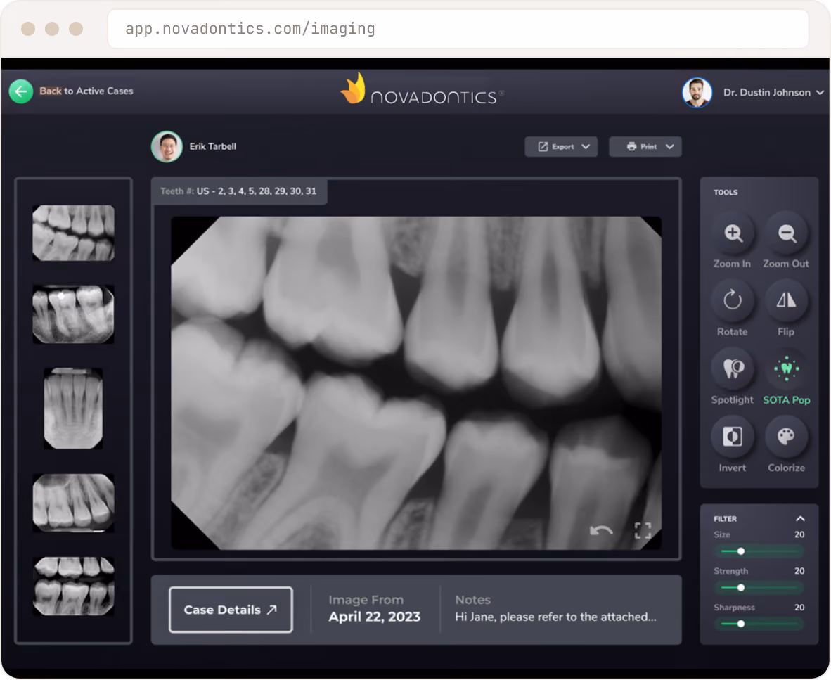 Dental X-ray images displayed in Novadontics app with tools for zoom, rotate, flip, and filters.