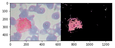 Blood cell image captured by Athelas One with AI-based image analysis.