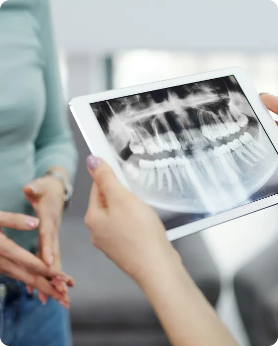 Person holding a tablet showing a dental X-ray image while talking to another person.