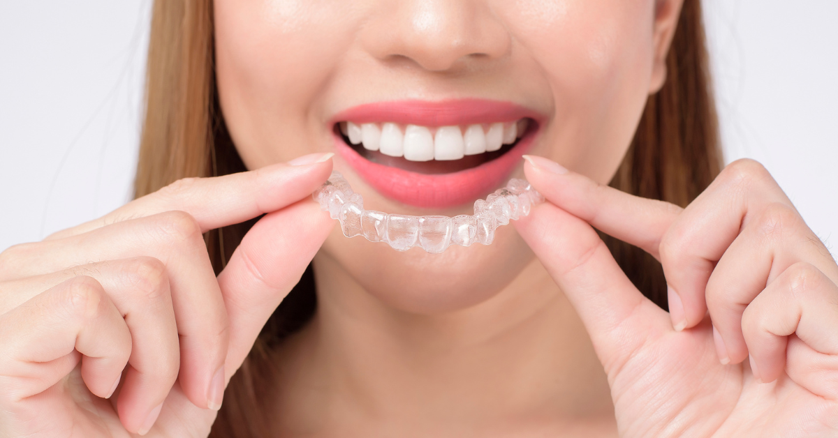 How Does Invisalign® Work?