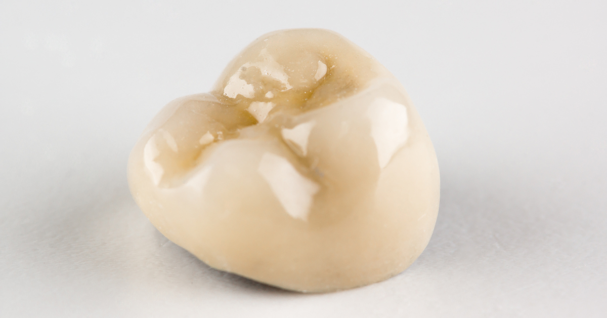Is A Broken Temporary Crown A Dental Emergency?