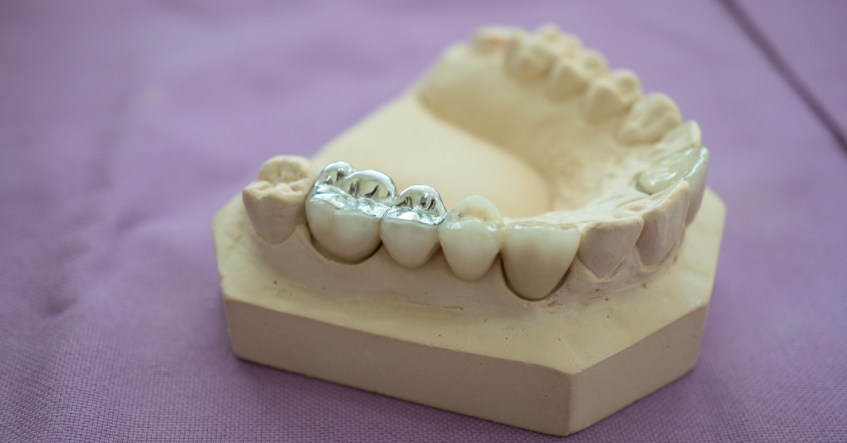 What Are Dental Fillings Made Of?