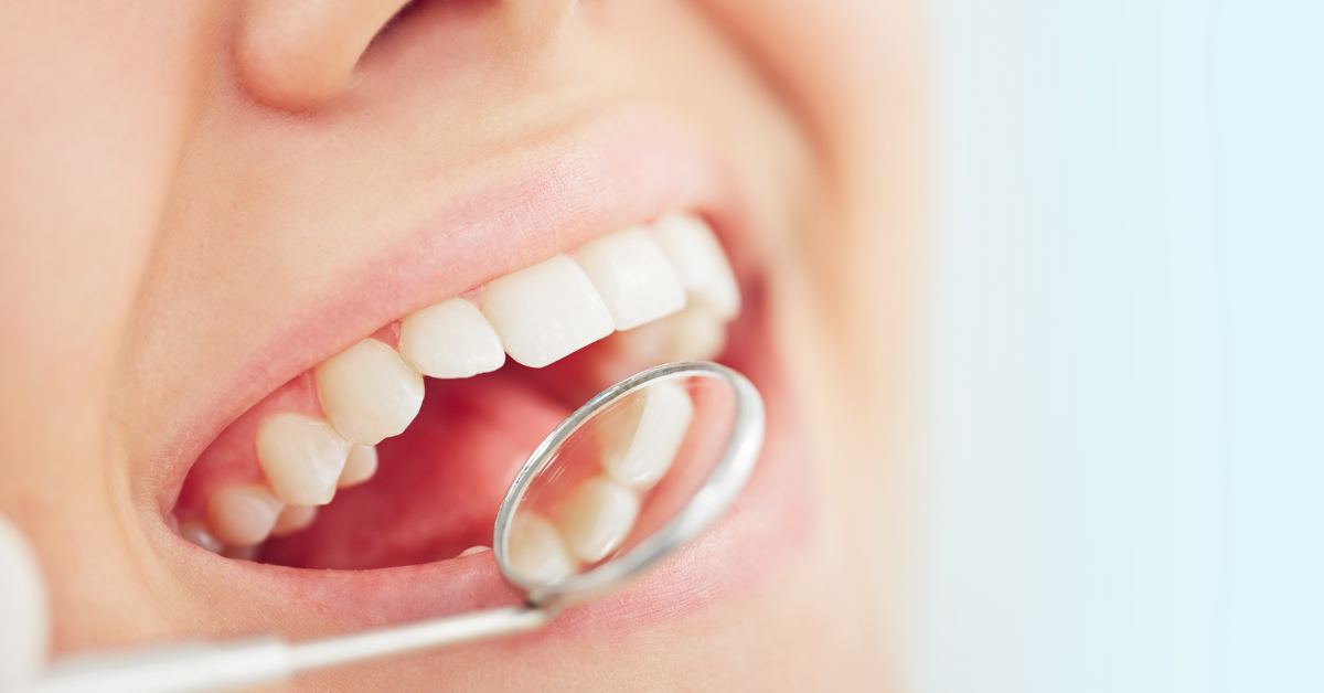 Why Dental Checkup Is Important?
