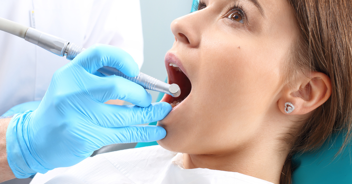 Why Would You Need A Root Canal?