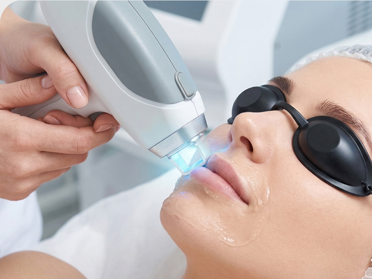 Person erhält eine hautstraffende Laserbehandlung im Gesicht, trägt Schutzbrille.