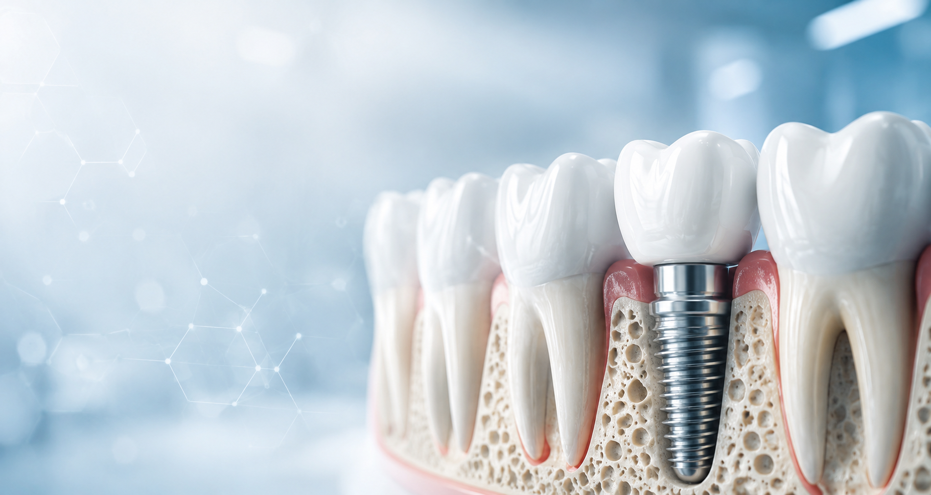 Before and after smile result — shared with patient consent