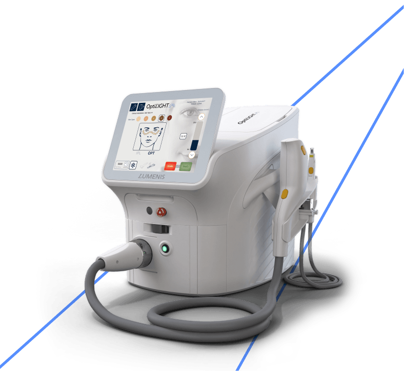 OptiLight by Lumenis intense pulsed light device used for dry eye treatment