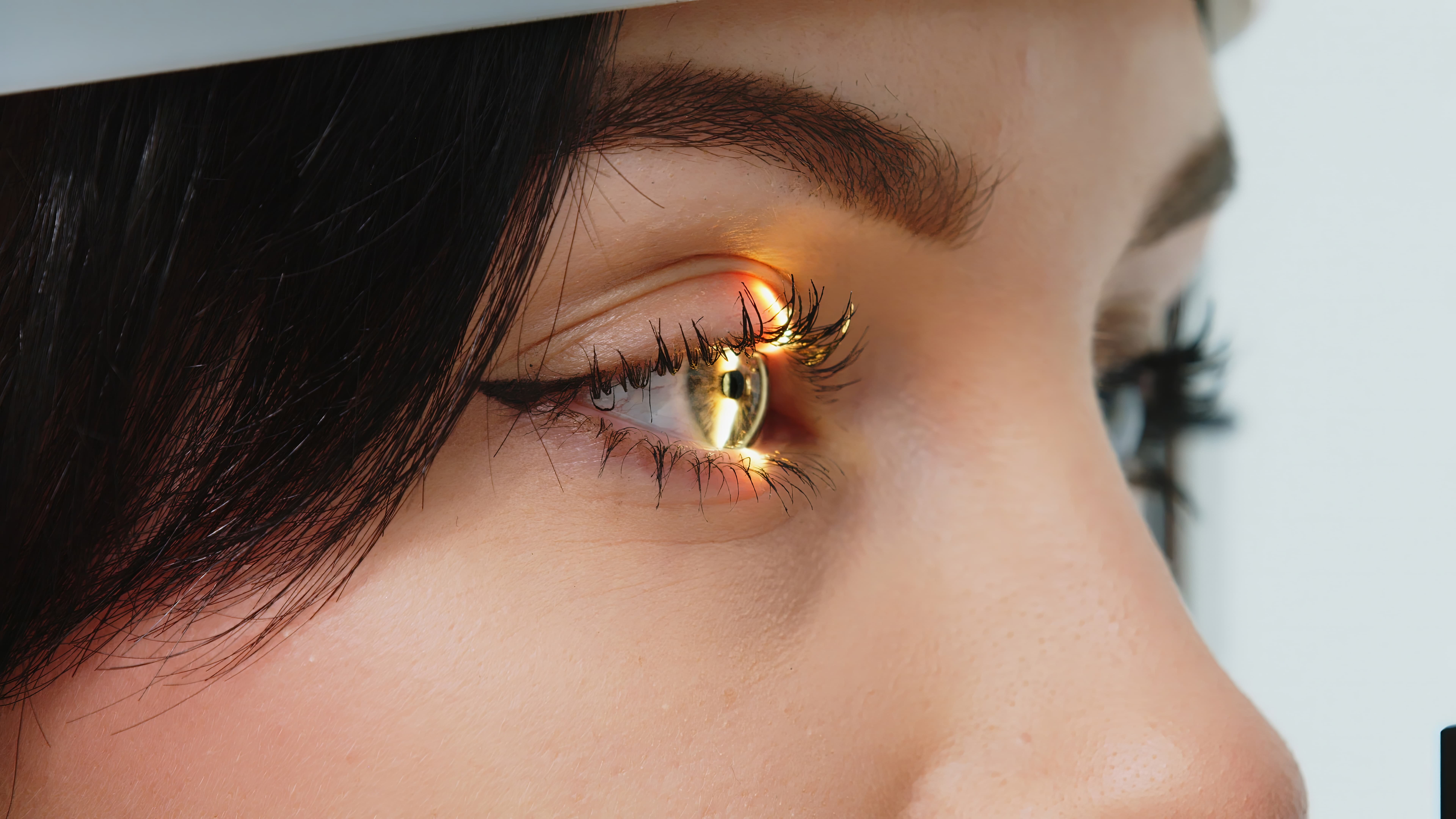 Close-up of a woman's eye undergoing an eye exam with a light reflecting in the pupil.