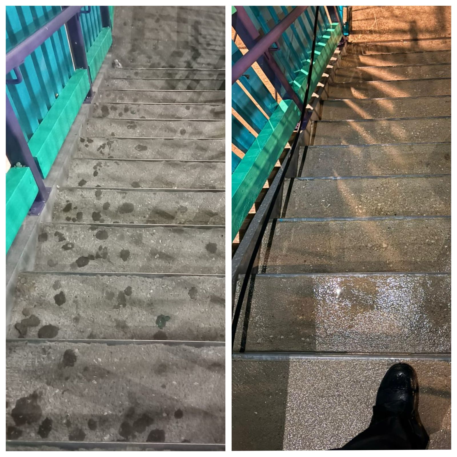 Gum removal results