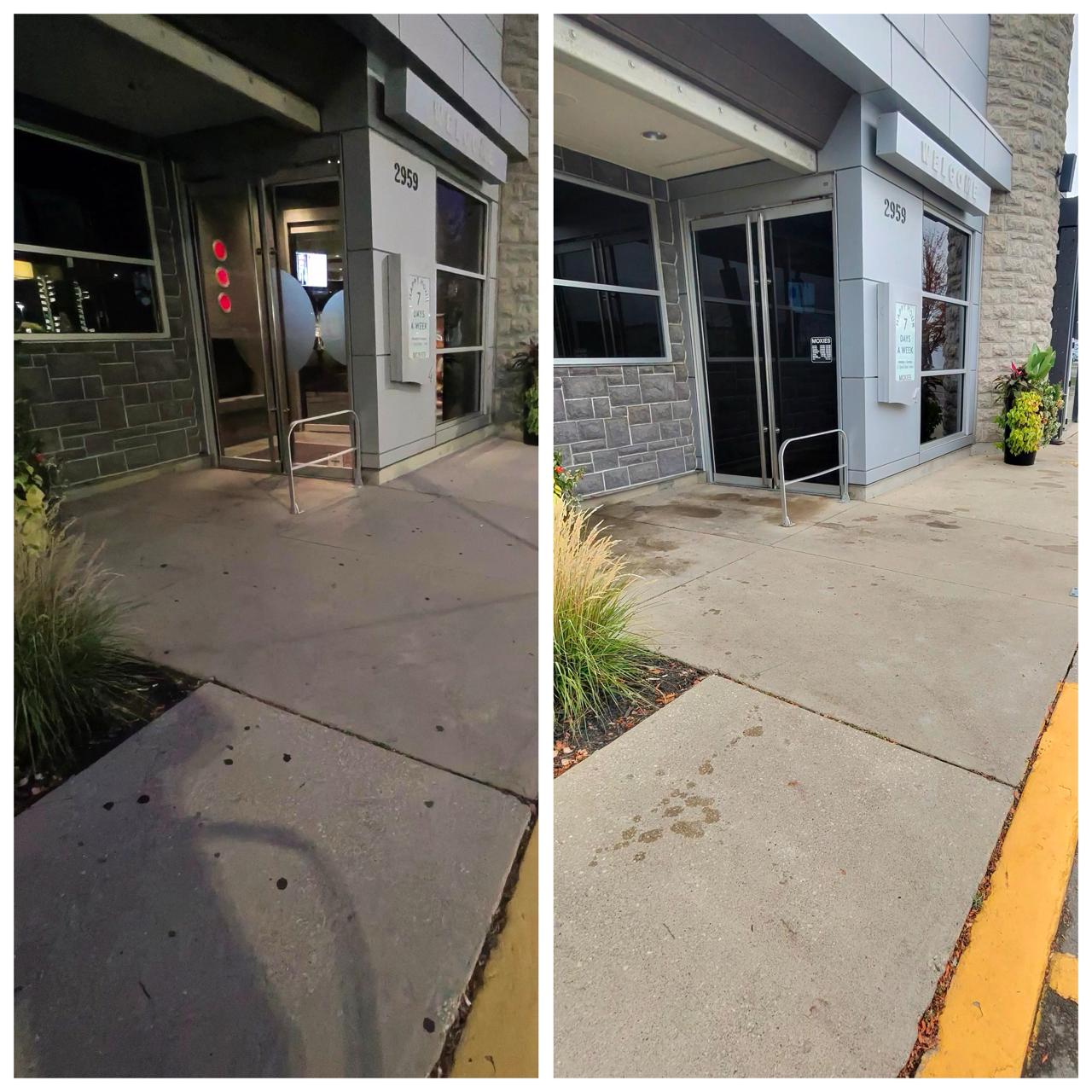 Gum removal results