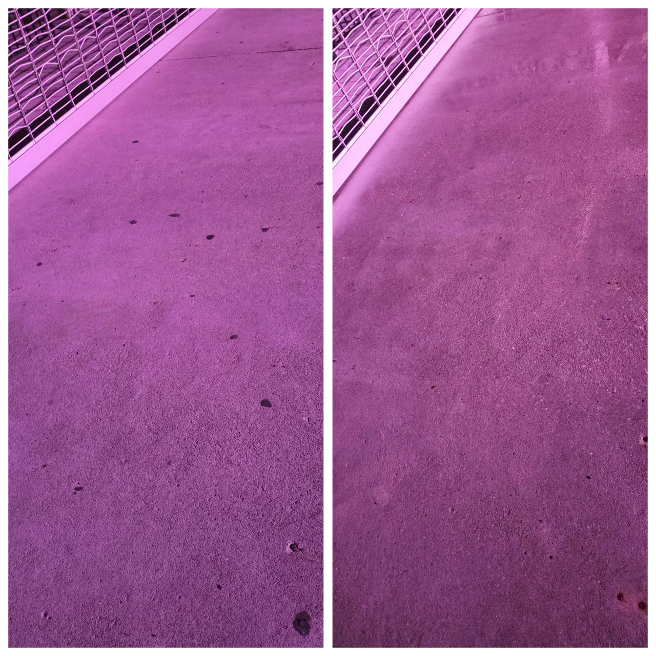 Gum removal results