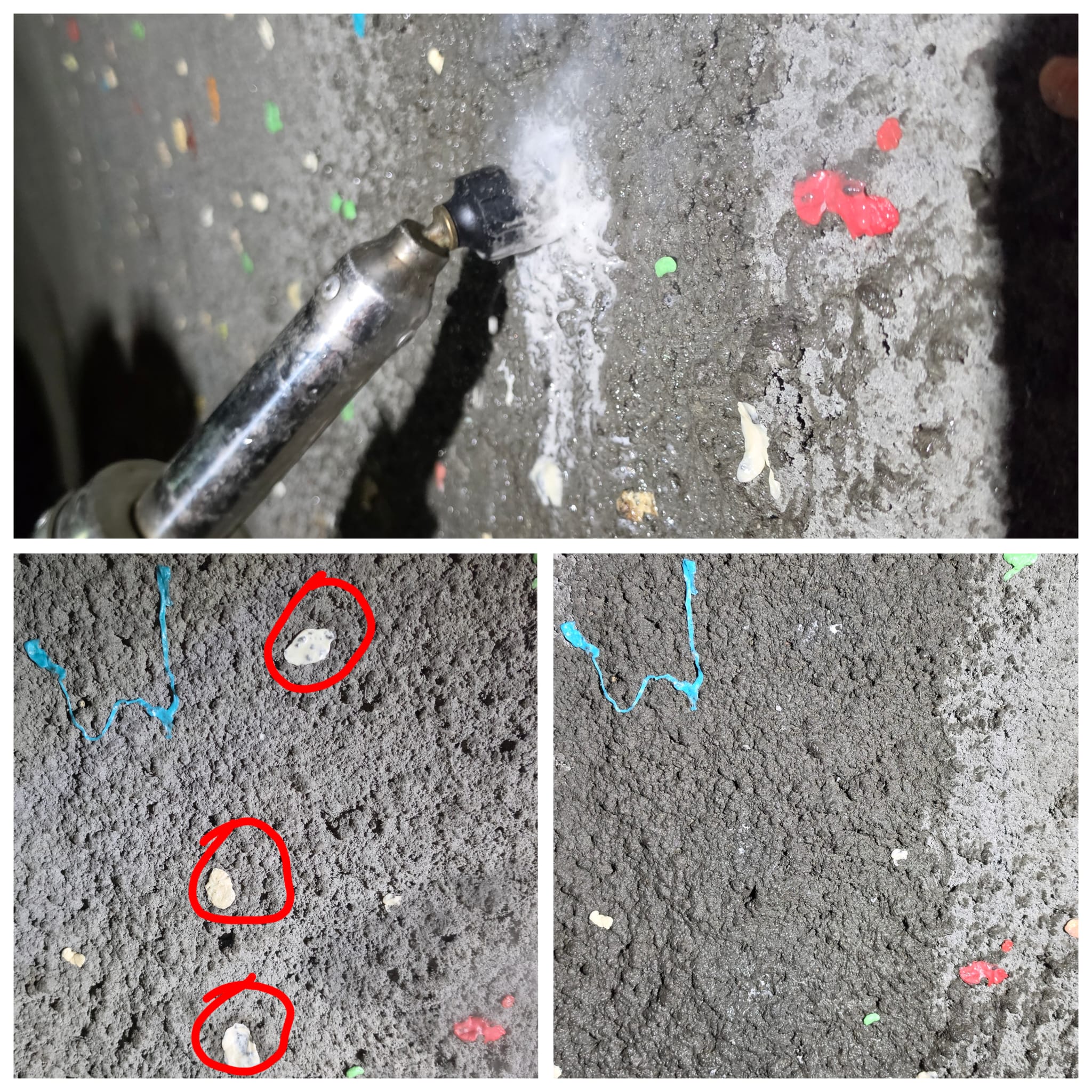 Gum removal results