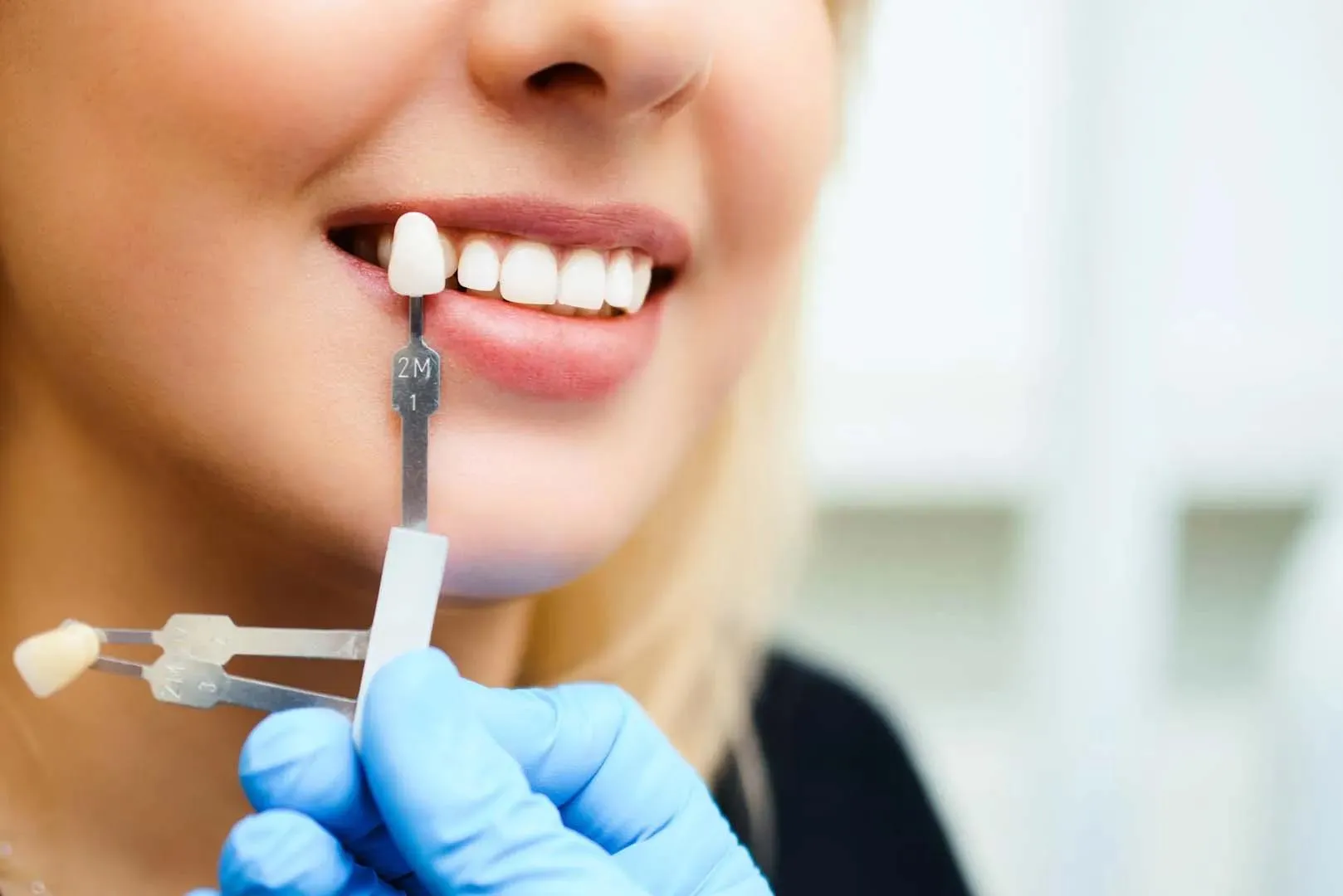 Gloved hand holding dental shade guides next to a smiling woman's teeth for color matching.