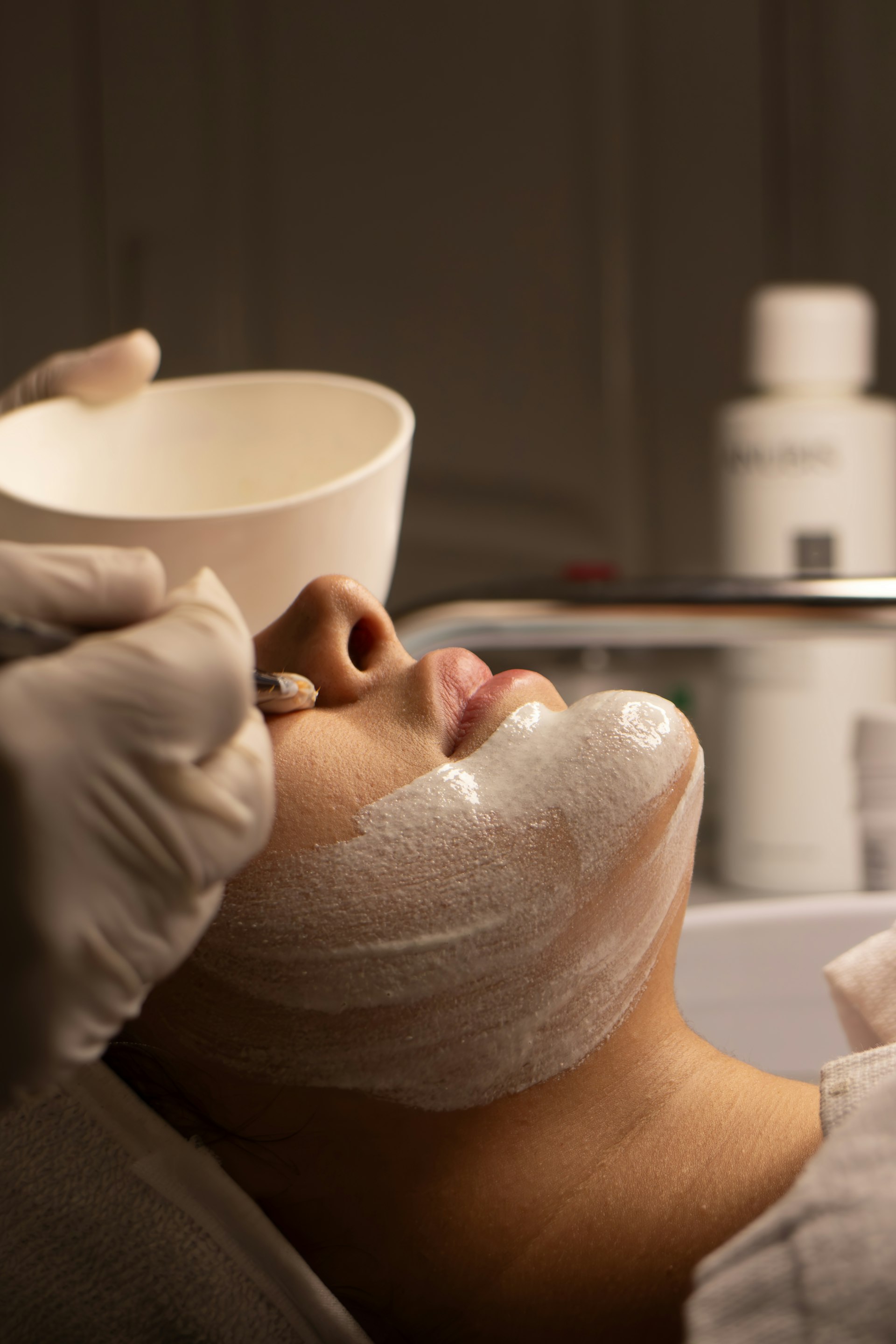 Microneedling and RF treatment at Vue Medical Spa in Salt Lake City