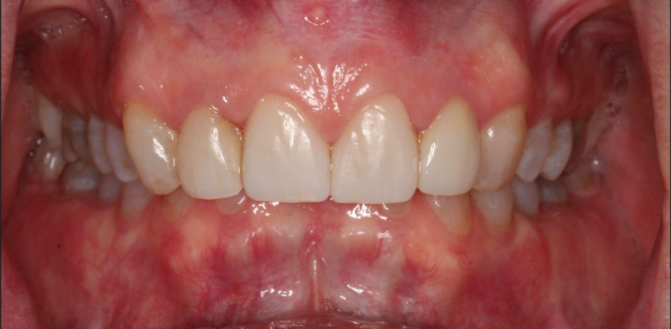 Before Image