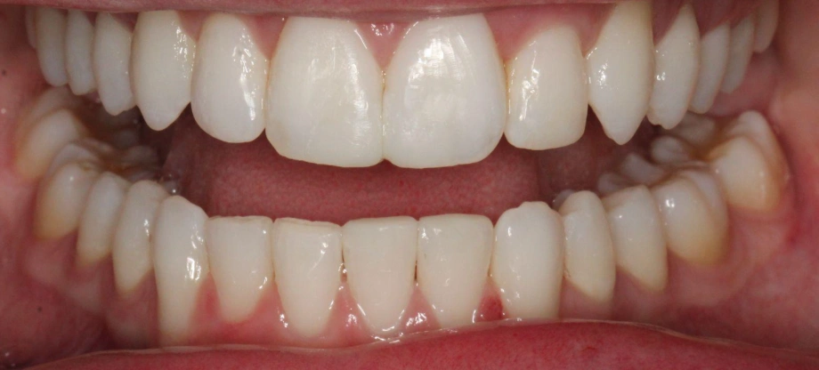 After Image
