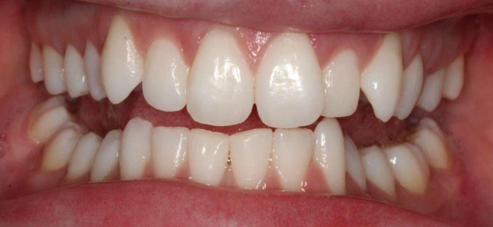 Before Image