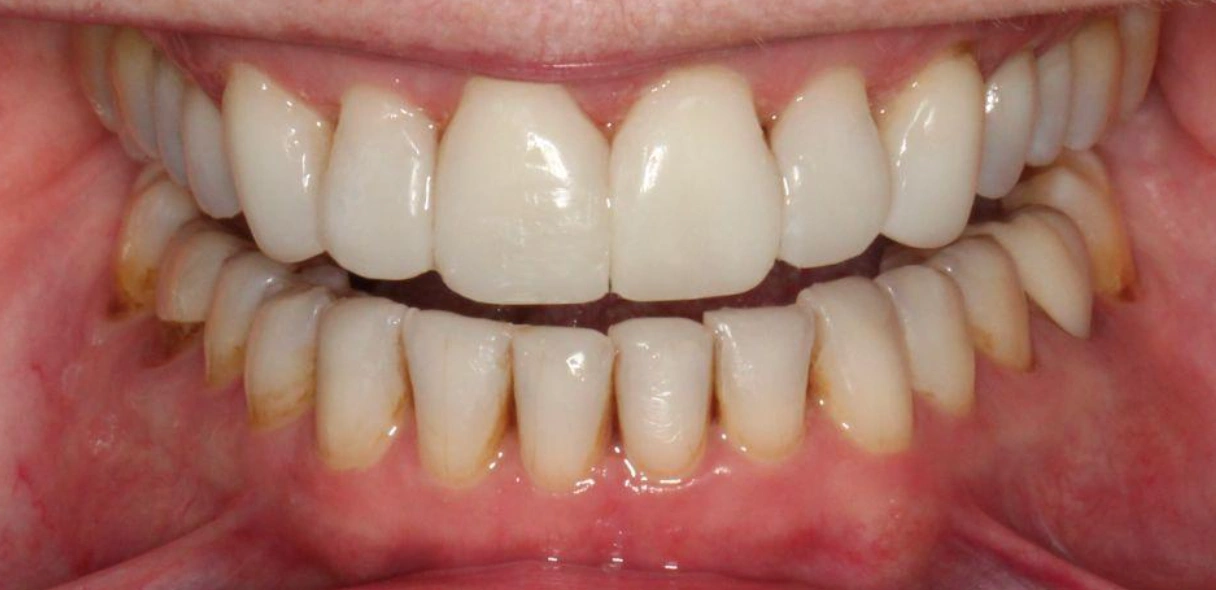 After Image
