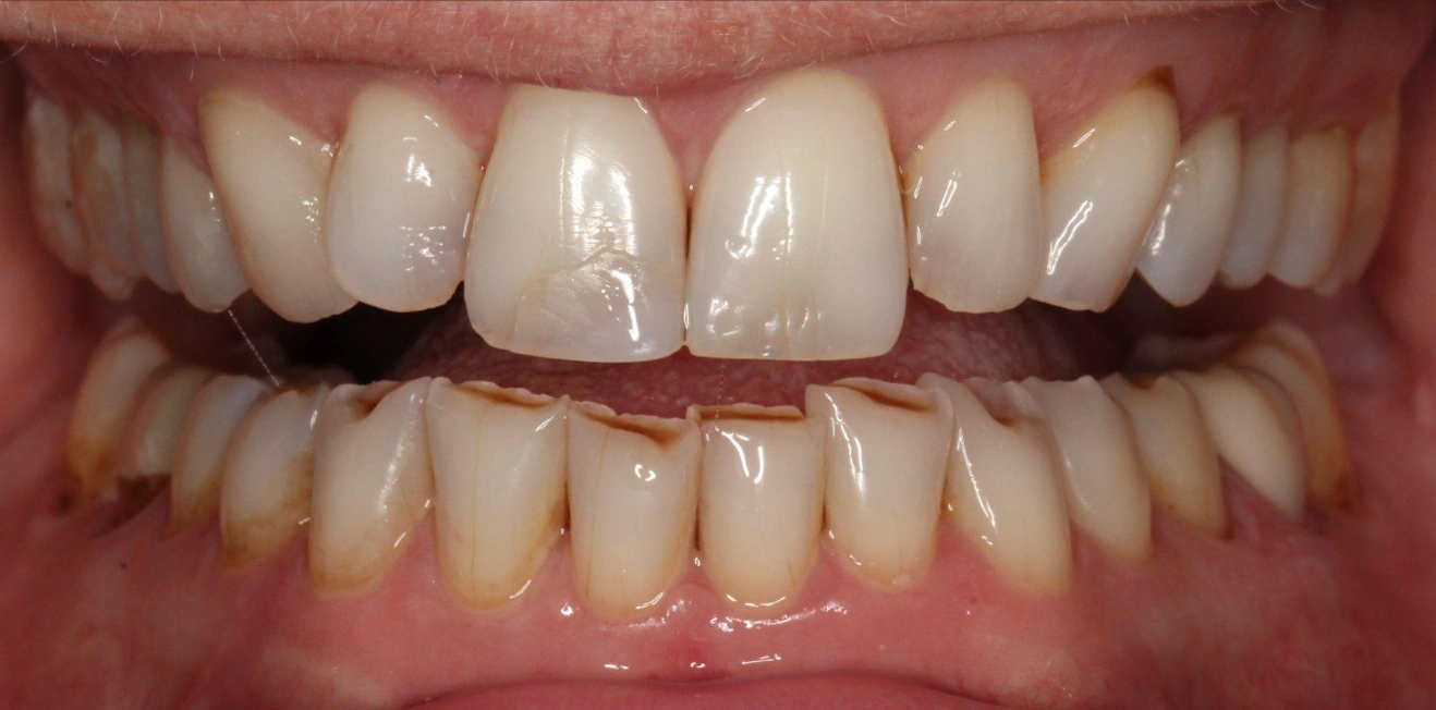 Before Image