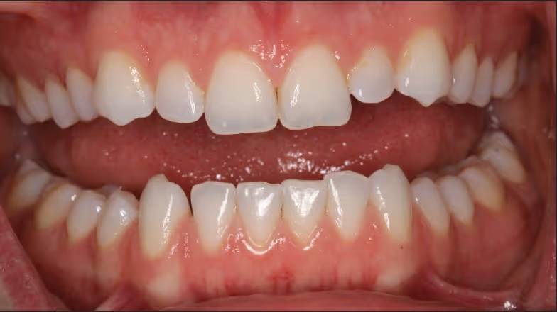 Before Image