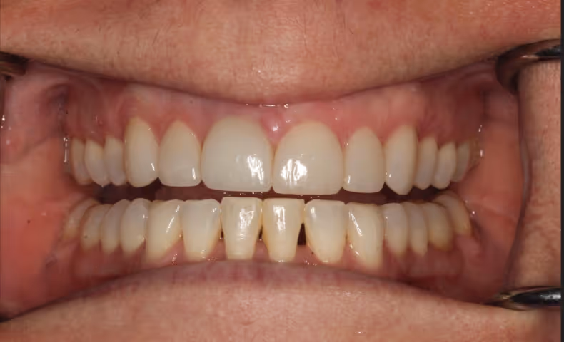 After Image
