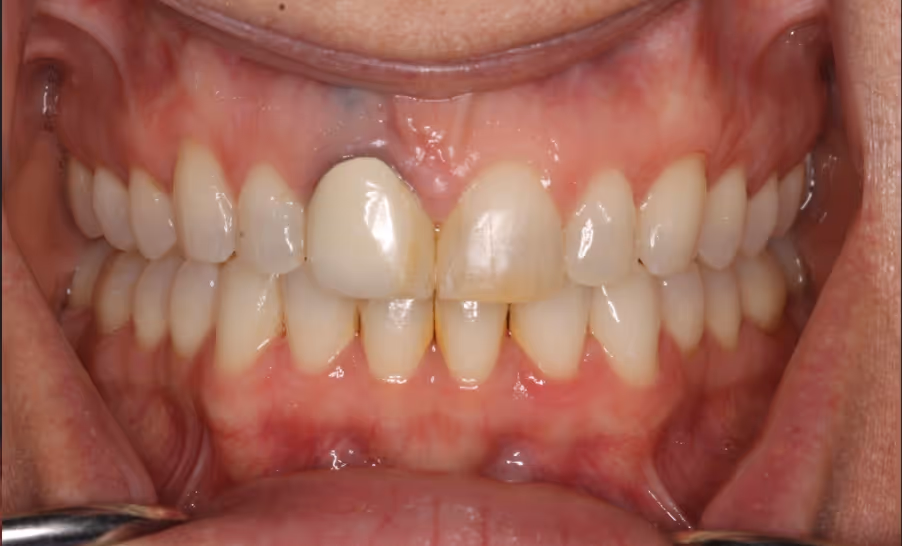 Before Image